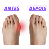 JoanetePro - Par de Meias de Correção Ortopédica