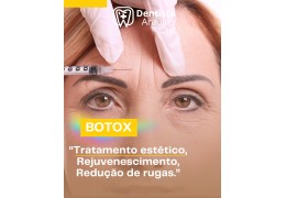 Tratamento Botox Recife
